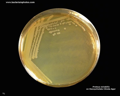 DCA agar